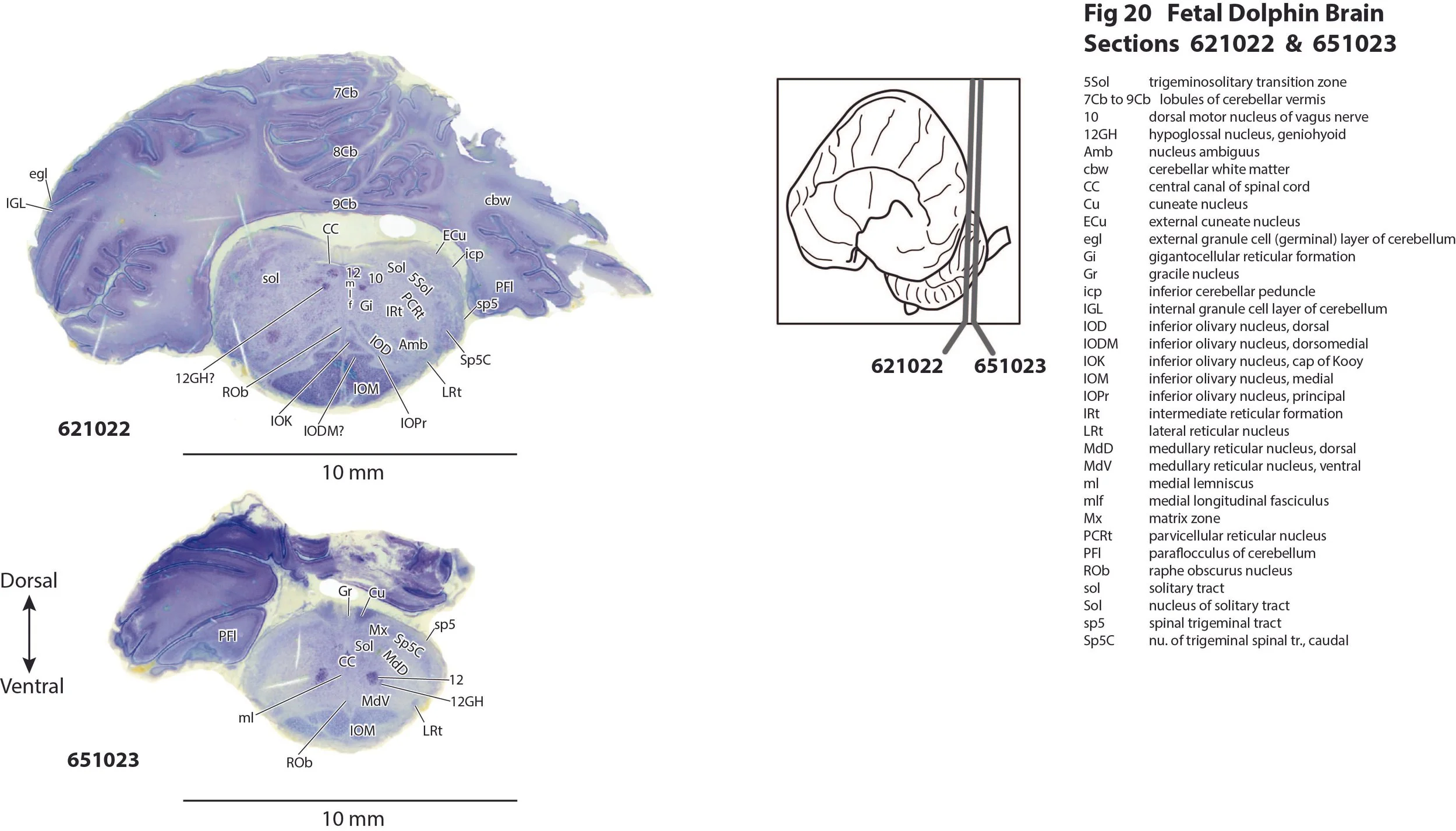 Atlas of the Brain of a Fetal Dolphin — Comparative Brain Anatomy